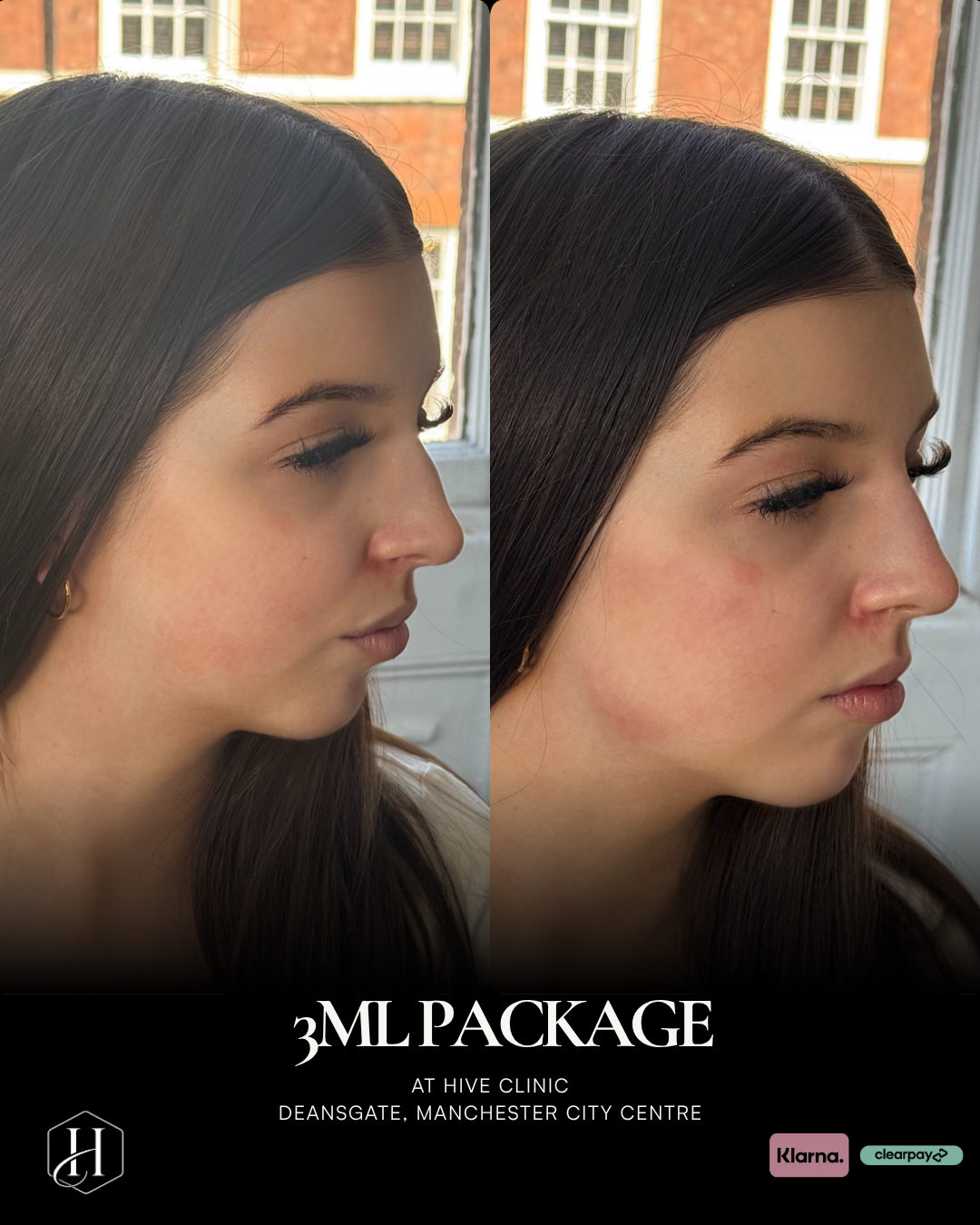 Facial Balancing