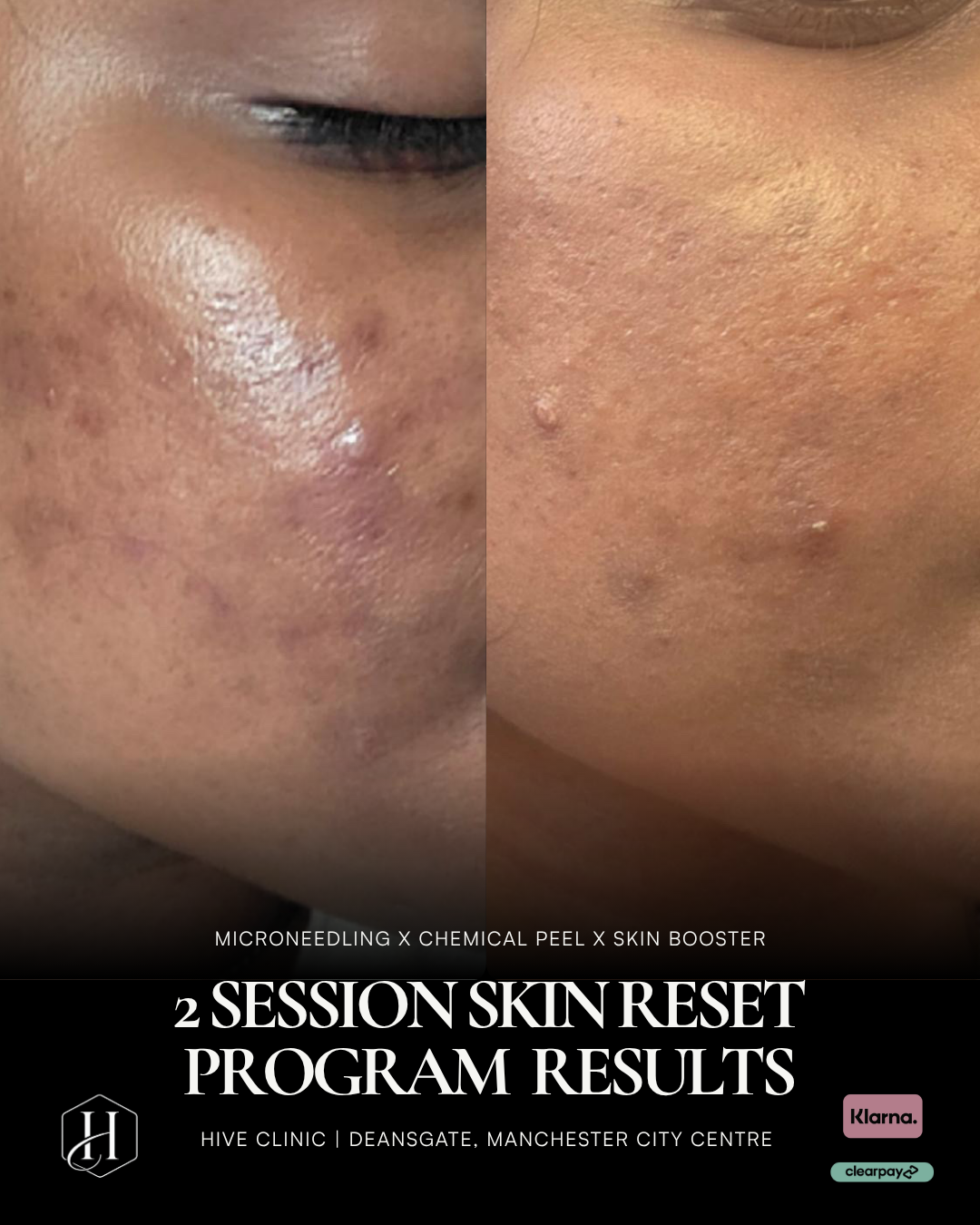 Skin Reset Programmes